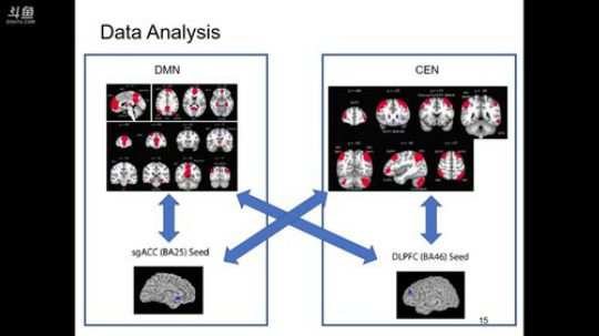 R-fMRI Journal Club 2017-11-10 08点场