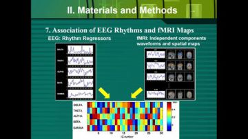 R-fMRI Journal Club 2017-07-28 09点场