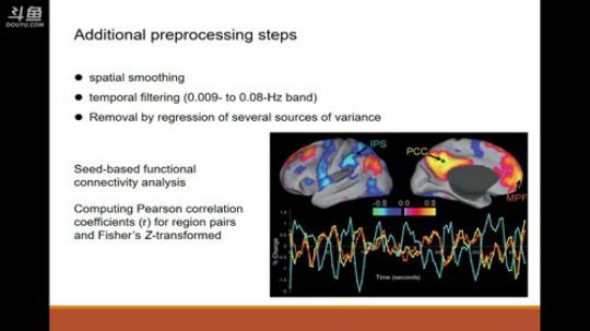 R-fMRI Journal Club 2017-12-29 09点场