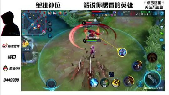 【骚白】电竞歌神上线，说好的单挑，叫队友过分了！