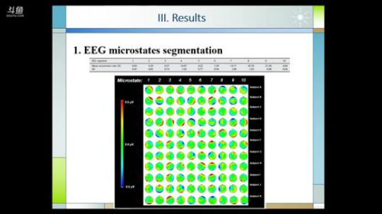 R-fMRI Journal Club 2018-04-20 08点场