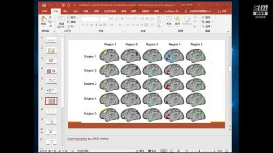 R-fMRI Journal Club 2018-11-30 09点场