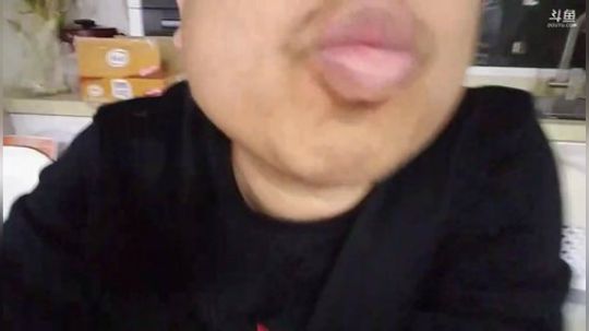 大嘴唇渣