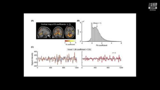 R-fMRI Journal Club 2019-07-19 09点场