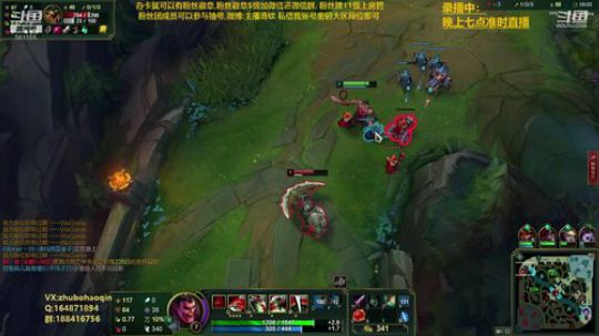 宇宙最骚诺手,细节之王 2019-10-02 08点场