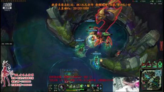 世界顶尖阿卡丽：新版讲解，一学就会嗷！ 2019-12-18 14点场