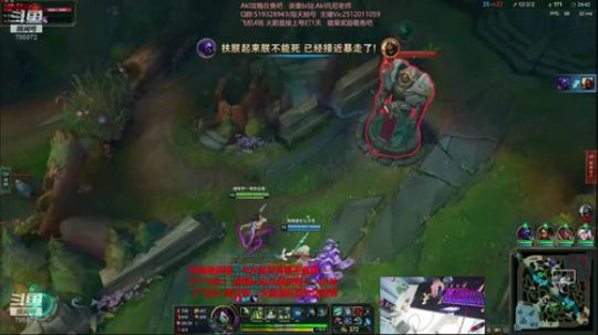 世界顶尖阿卡丽：新版讲解，一学就会嗷！ 2020-01-22 10点场