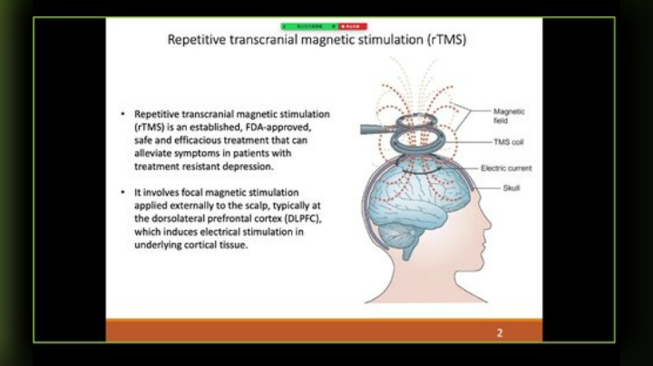 R-fMRI Journal Club 2020-06-19 08点场