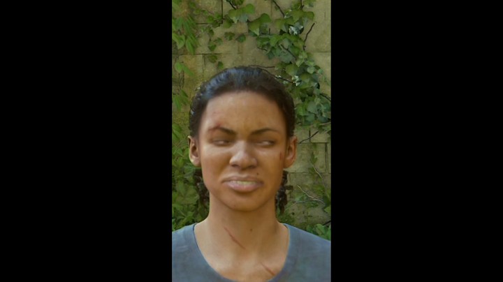 【默默】你眼睛怎么了？妹妹