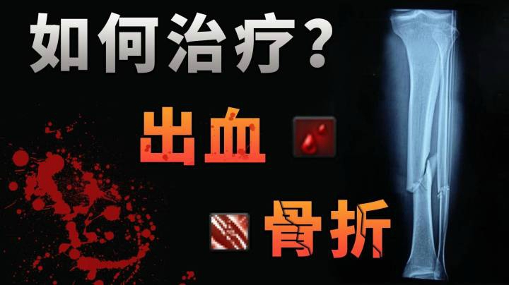 当你遇上 出血 和 骨折 等危机情况 该如何救治自己和他人 森纳映画的鱼吧 斗鱼鱼吧