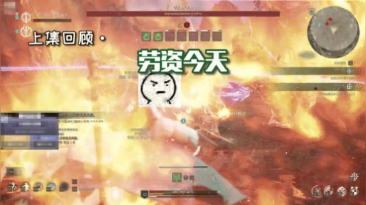 战非日常 就算刮痧也要上