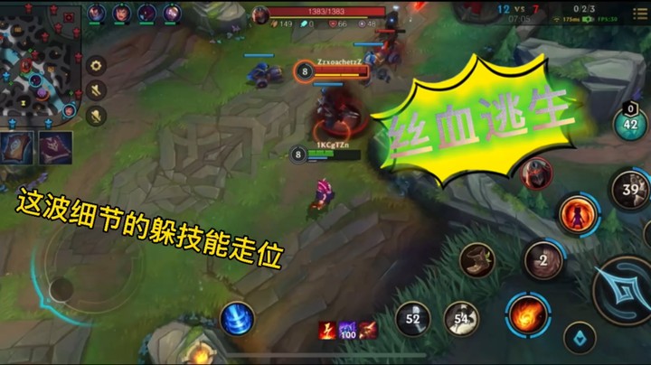 细节就是这样拉扯一丝丝就是不死