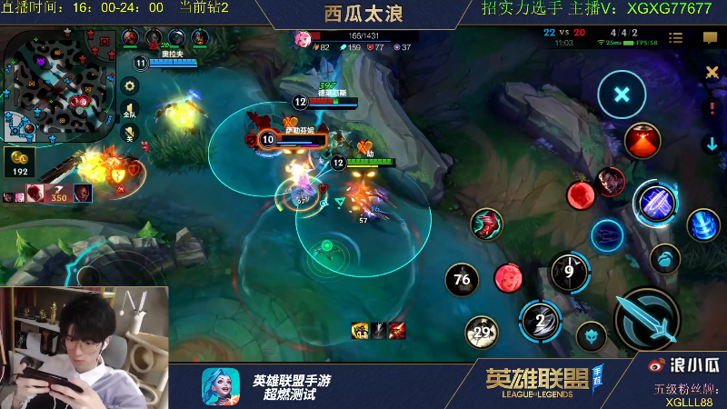 【LOL手游】西瓜太浪xx的精彩时刻 20210804 07点场