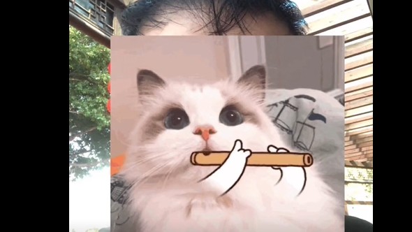 没东西发，发植发五个月效果对比图！头发多好烦呀植发还瘦了30斤