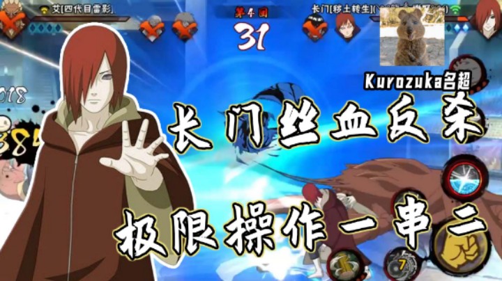 【名超】长门丝血反杀，极限操作一串二！