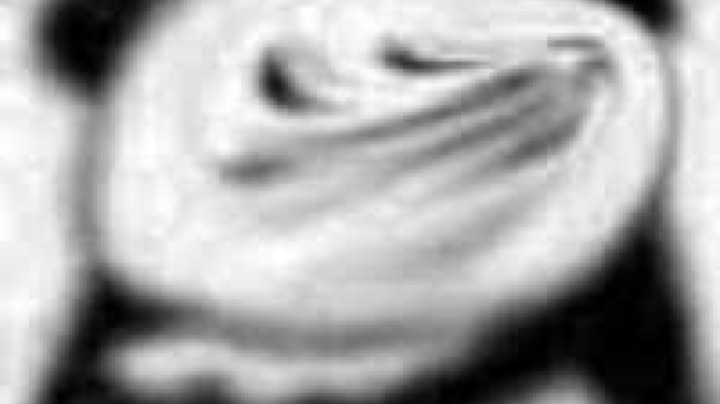 44