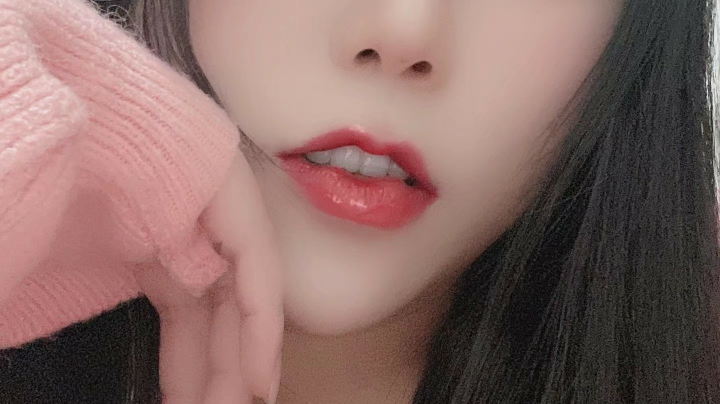 云顶
