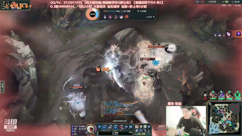 【2021-12-17 00点场】Akl托尼老师：世界顶尖阿卡丽：极致细节教学！