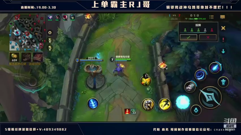 【2021-12-17 01点场】心星丶RJ：AD上单 版本答案