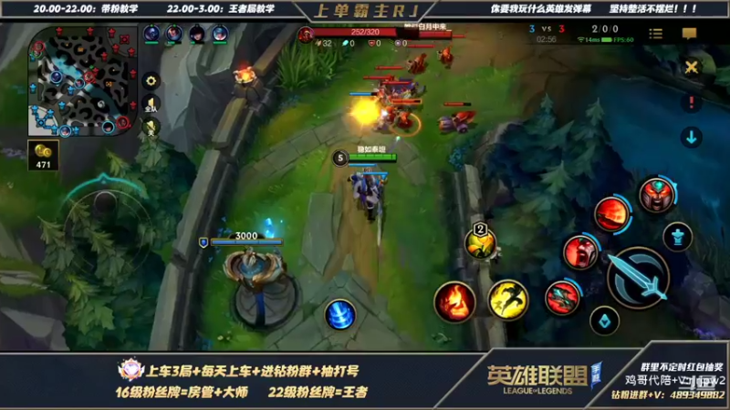 【2022-03-01 20点场】心星丶RJ：上单霸主 全网最细