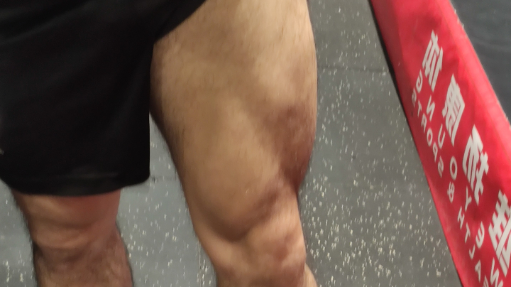 今天练手臂，明天练大腿。