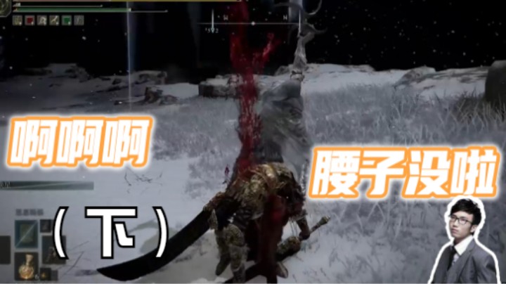 捅我腰子是吧
