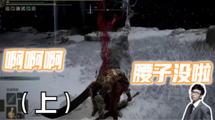 腰子被捅啦