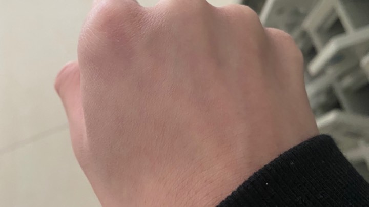 手