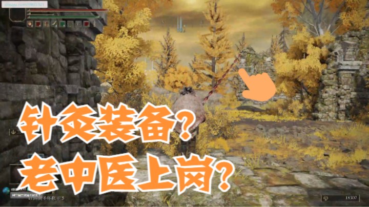 鲜血贵族：老中医妙手回春啊