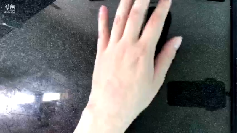 【2022-05-30 12点场】余贰人：3：挂完盐水来