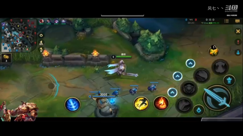 盖伦对战瑞文日常讲解（1）