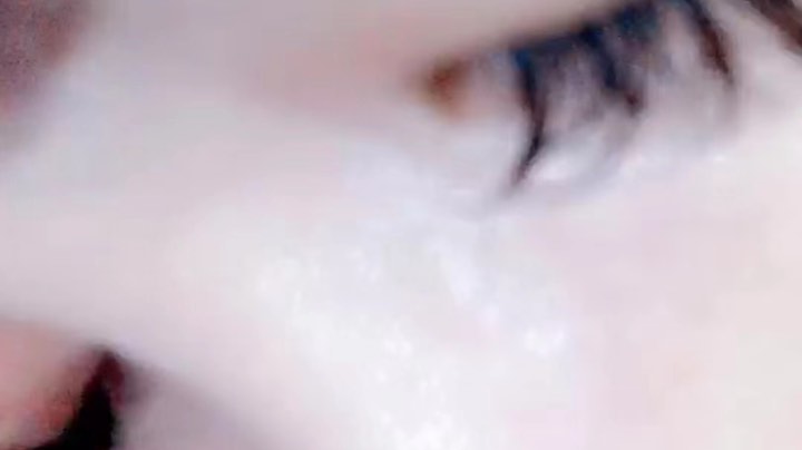 拔牙之后的小fw