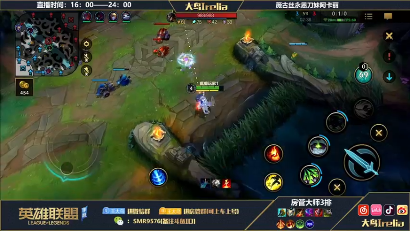 【2022-10-28 18点场】大鸟Irelia：大鸟：新英雄体检薇古丝！