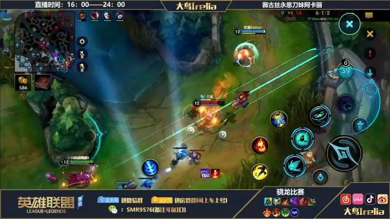 【2022-10-29 20点场】大鸟Irelia：大鸟：最强薇古丝永恩刀妹降临！