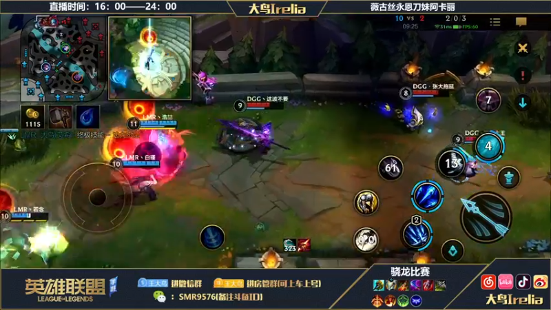 【2022-10-29 18点场】大鸟Irelia：大鸟：最强薇古丝永恩刀妹降临！
