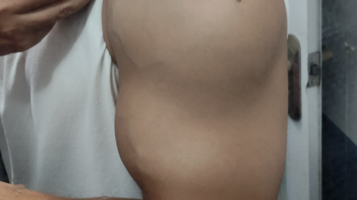 第2次恢复手臂训练。