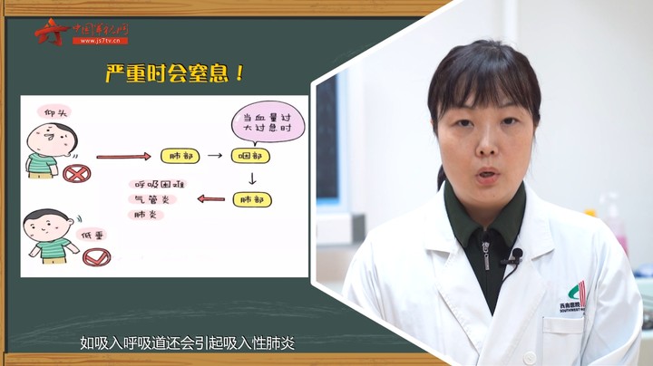 【军视问答】健康必修课：流鼻血时仰头可以止血吗？