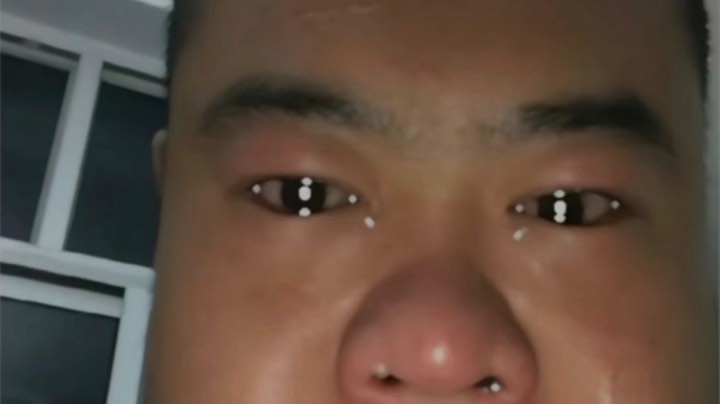 疫情