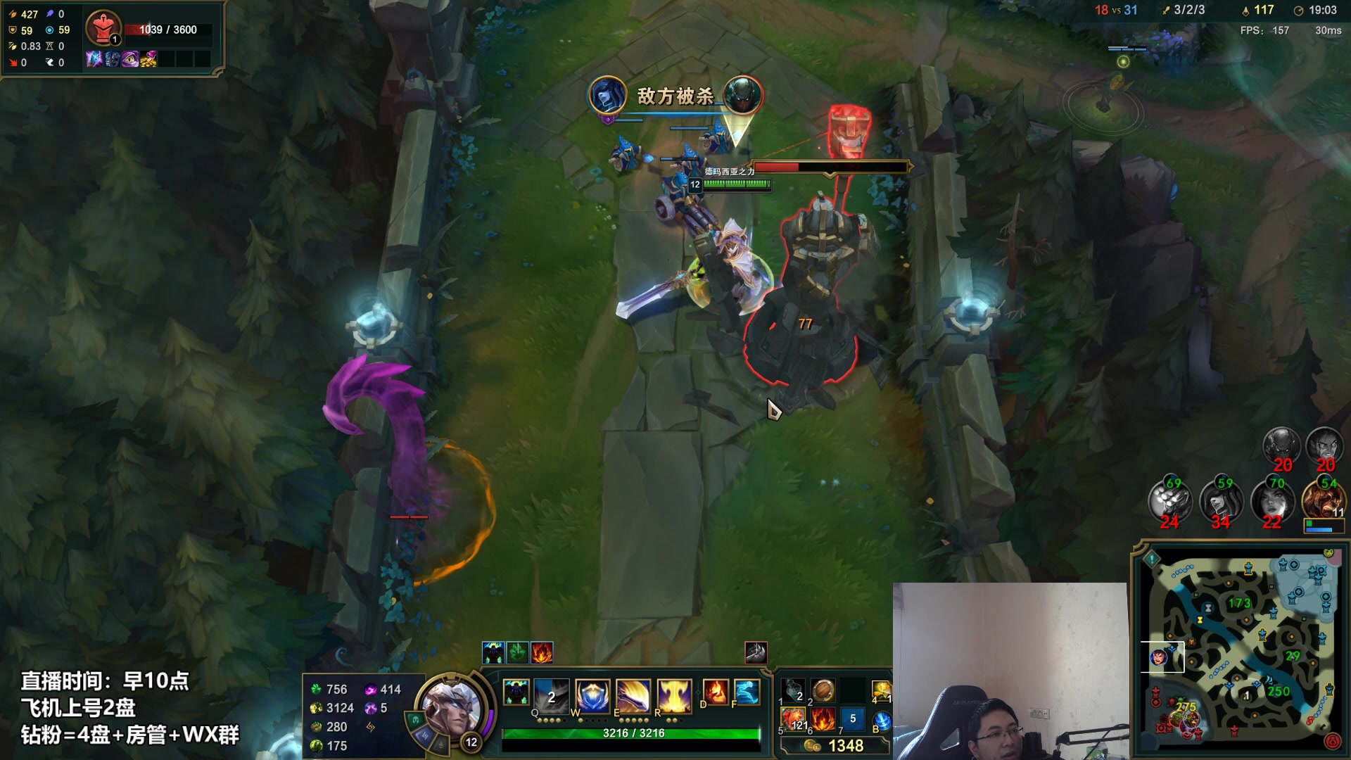 【2023-01-12 13点场】店长盖伦：直播 康复训练