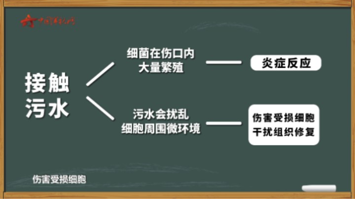 【军视问答】健康必修课：伤口遇水 容易感染吗？