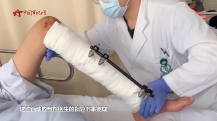 【军视问答】健康必修课：伤筋动骨100天，期间应当限制活动吗？
