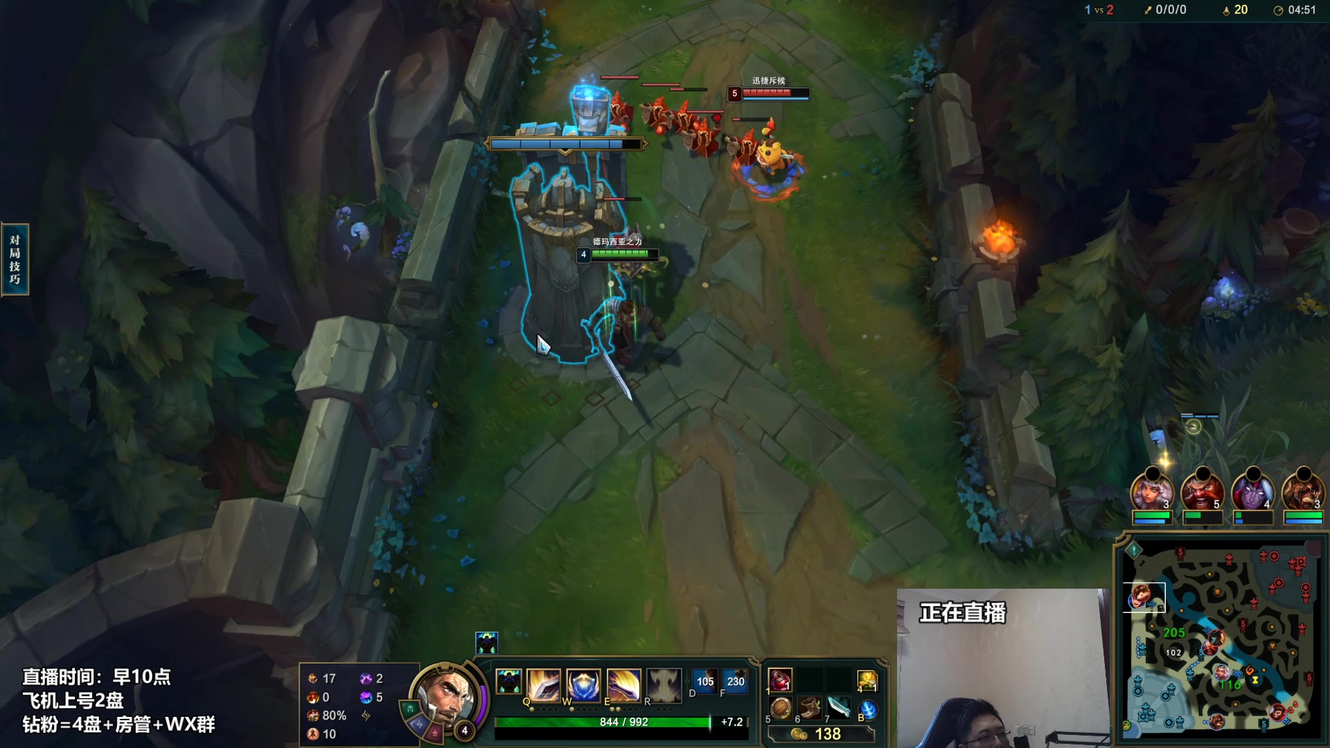 【2023-02-15 11点场】店长盖伦：正在直播 国服最细盖伦