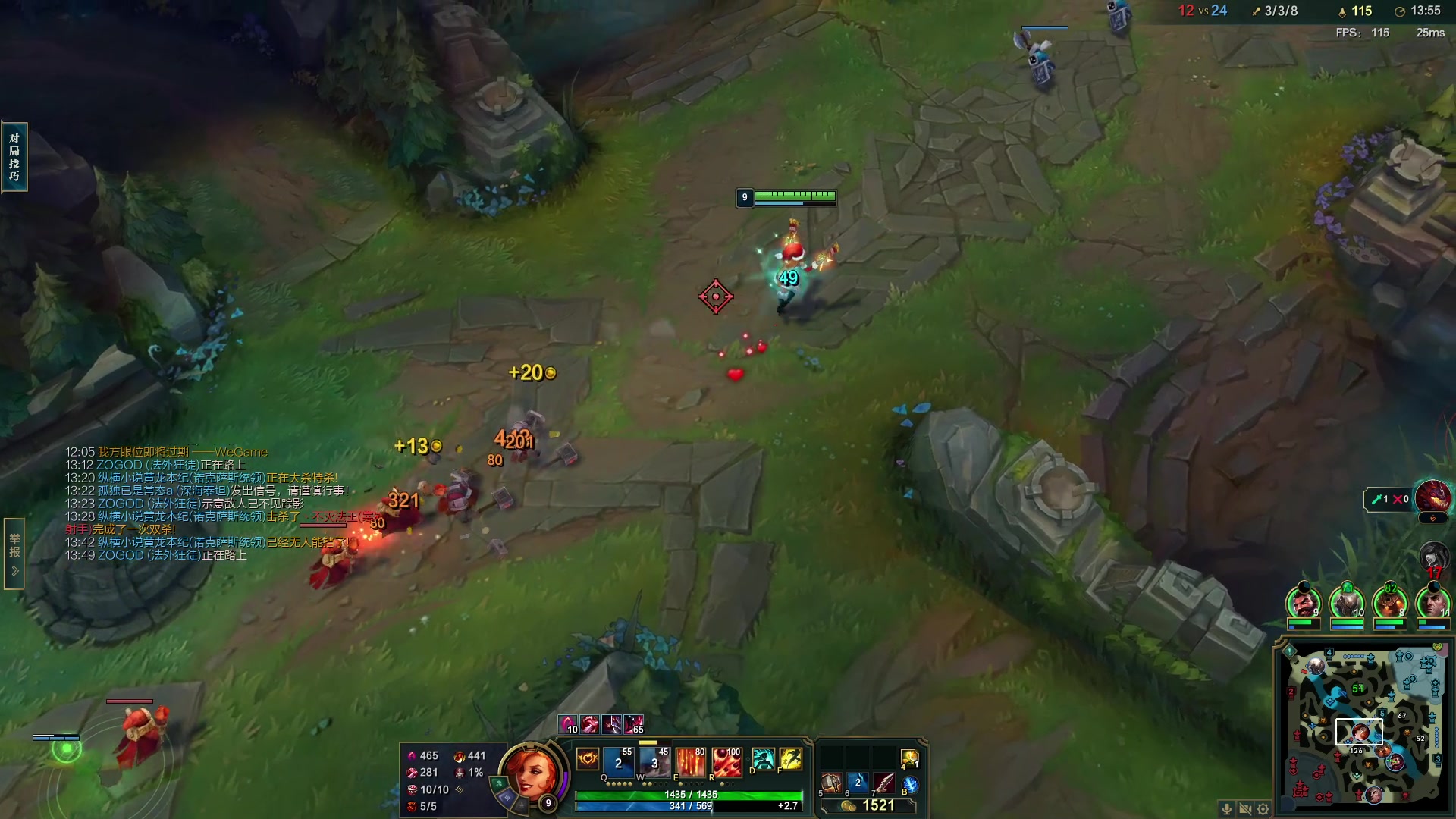 【2023-02-22 20点场】夏天夏天丶丶：女枪新版出装