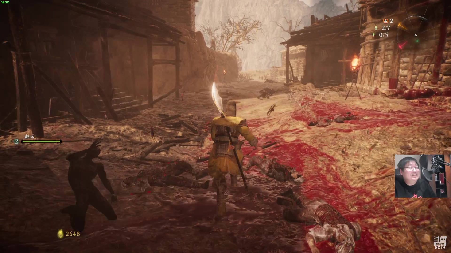 【2023-02-26 23点场】毕游侠：风寒感冒，难受