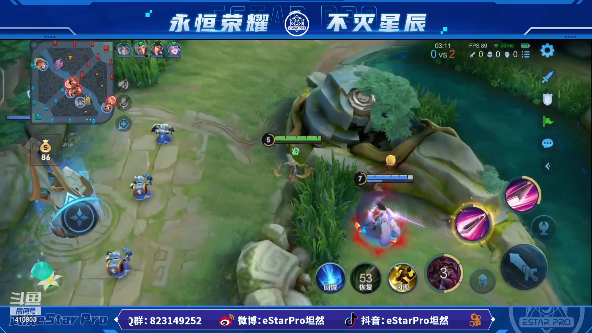 【2023-03-01 10点场】eStarPro坦然：打一会儿游戏~