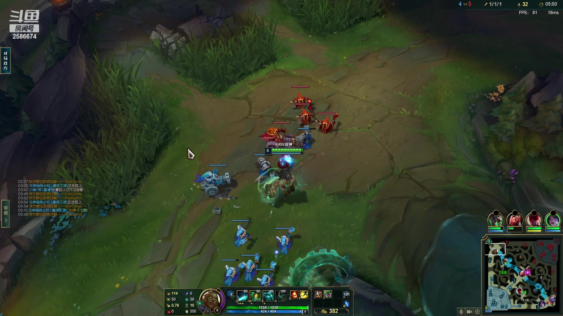 【2023-03-09 21点场】夏木AWT：锤石练习中