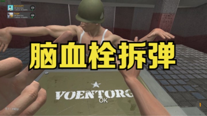 脑血栓拆弹 | 双人合作