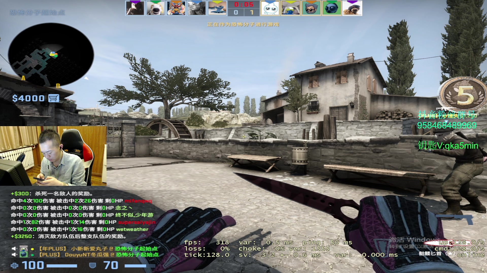 【2023-03-31 21点场】QKA付志海：【QKA】4月4号植发怎么说,户外