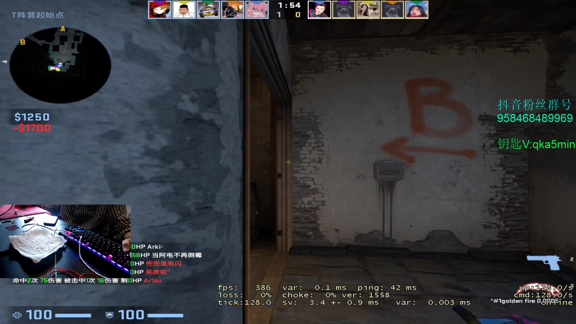 【2023-04-05 15点场】QKA付志海：【QKA】手术完成，不能开摄像头，巨瓦