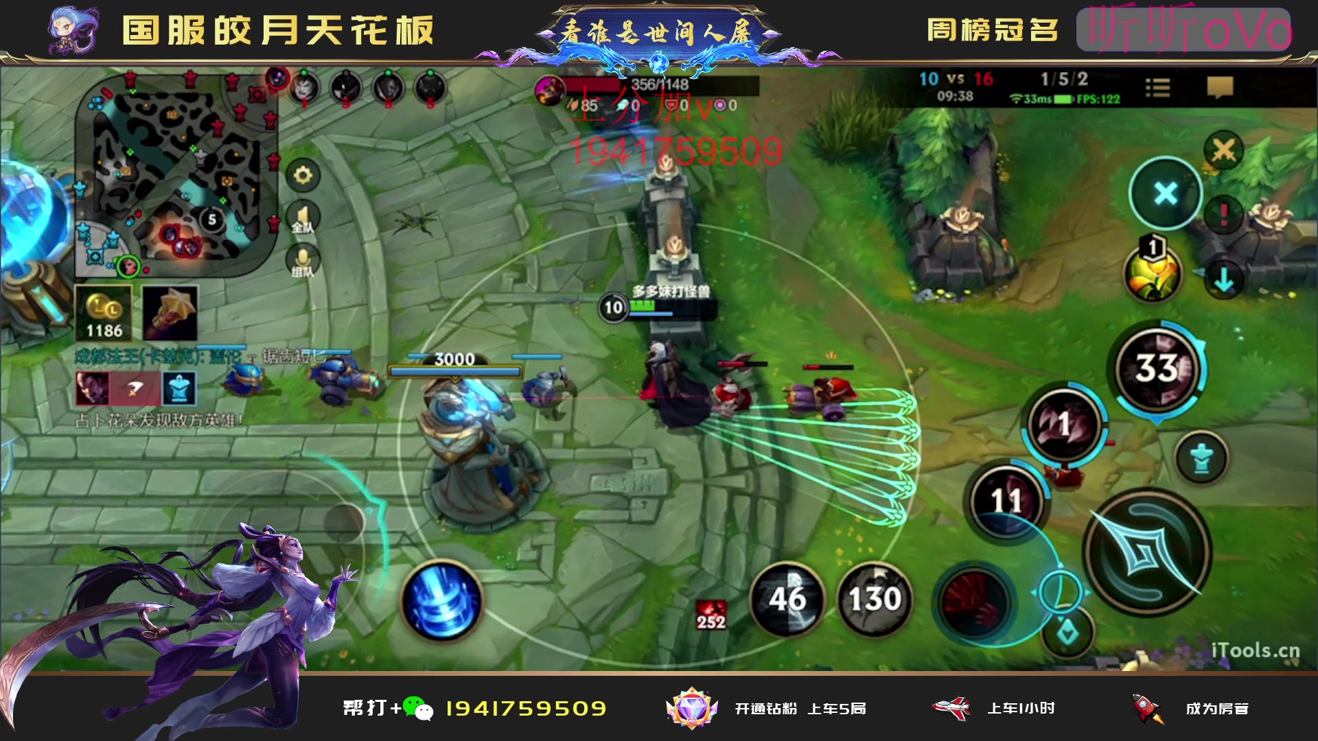 【2023-06-12 14点场】看谁是世间人屠：重回国一 康复训练
